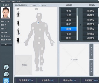 北京天地智慧醫(yī)療設(shè)備DR平臺(tái)界面設(shè)計(jì)